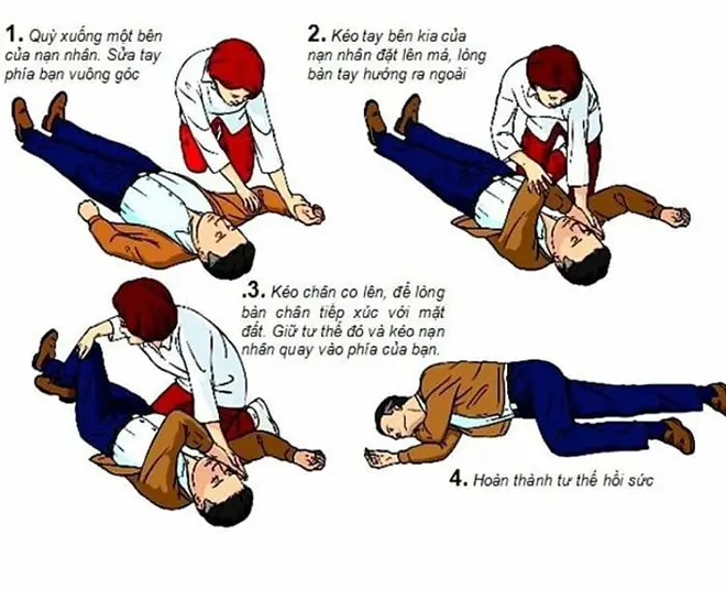 Sai Lầm Khi Cấp Cứu Đột Quỵ – Những Hiểu Lầm Chết Người Cần Tránh