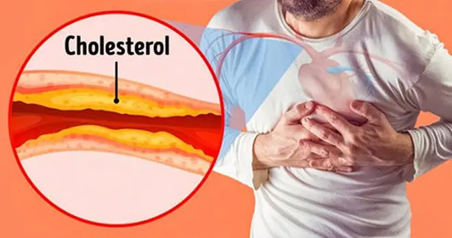 Giảm mỡ máu sớm – Sống khỏe lâu dài