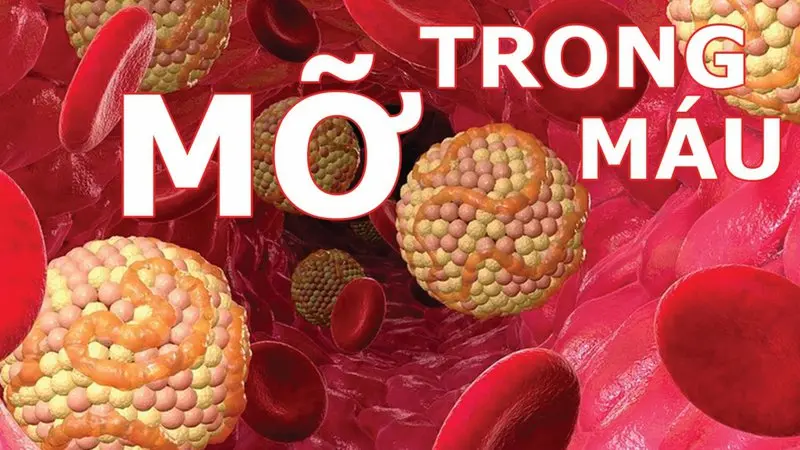 Cơ thể bạn đang gánh lượng mỡ nhiều gấp đôi giới hạn an toàn – nhưng bạn vẫn chưa hề hay biết